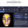 Huid Analyse apparaat SmartSkin