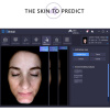 Huid Analyse apparaat SmartSkin