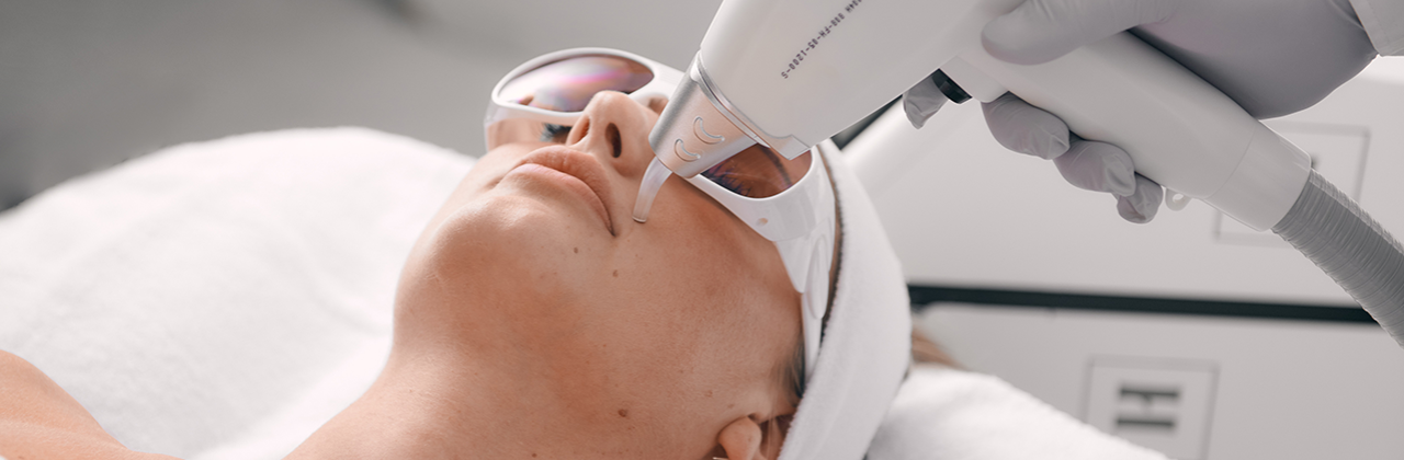 Laser ontharen: De 10 meestgestelde vragen
